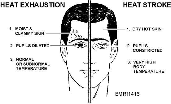 Heat Exhaustion vs. Heat Stroke